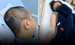 Đang ăn cơm cùng chồng, người phụ nữ đột ngột lịm đi, vỡ mạch máu não