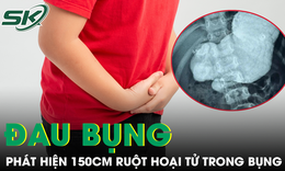 Nam sinh đau bụng, bác sĩ phát hiện 150 cm ruột hoại tử