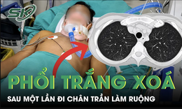 Thanh niên 20 tuổi phổi trắng xóa sau một lần đi chân trần làm ruộng