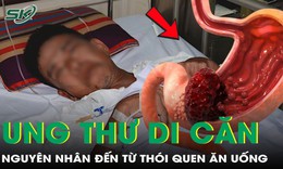 Mắc ung thư dạ dày di căn, nam tài xế 'bật khóc' vì nguyên nhân