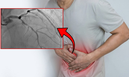 Đau thượng vị, người đàn ông phát hiện 3 nhánh mạch vành tổn thương nặng