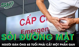 Sỏi đường mật khiến người đàn ông 65 tuổi phải cắt một phần gan
