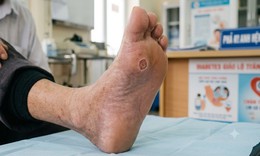 5 nhóm người không nên ngâm chân