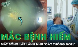 Mắt bỗng lấp lánh như 'cây thông Noel', người phụ nữ không ngờ mắc bệnh hiếm