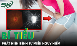 Bí tiểu kéo dài, người phụ nữ phát hiện bệnh tự miễn nguy hiểm