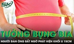 Tưởng bụng bia, người đàn ông 33 tuổi phát hiện khối u 15cm
