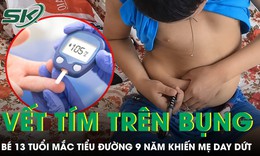 Bé trai 13 tuổi sống chung với tiểu đường 9 năm, chi chít những vết tím 