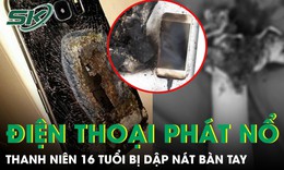 Điện thoại bất ngờ phát nổ khi đang sạc, nam thanh niên dập nát bàn tay