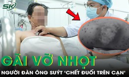 Gãi vỡ mụn nhọt, người đàn ông 50 tuổi suýt 'chết đuối trên cạn'