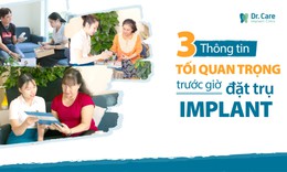 3 thông tin tối quan trọng trước giờ đặt trụ Implant phải biết
