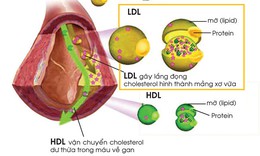 Thận trọng khi d&#249;ng thuốc hạ mỡ m&#225;u rosuvastatin