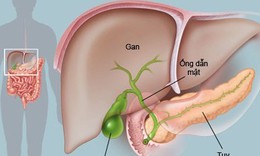 C&#243; cần chữa trị nang gan