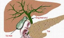 Dấu hiệu tố bạn bị nang gan