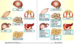 Hội chứng chuyển h&#243;a v&#224; nguy biến kh&#244;n lường