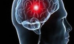 D&#249;ng Nalidixic acid qu&#225; liều c&#243; thể tăng &#225;p lực nội sọ