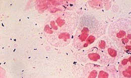 Chlamydia gây bệnh mắt hột