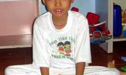 Điều trị loạn dưỡng cơ