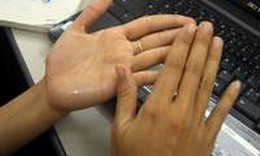 Ra nhiều mồ h&#244;i tay, chữa thế n&#224;o?