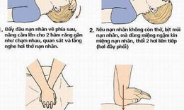 C&#225;ch h&#244; hấp nh&#226;n tạo v&#224; xoa b&#243;p tim ngo&#224;i lồng ngực