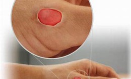 Lưu &#253; khi sử dụng thuốc chống nấm