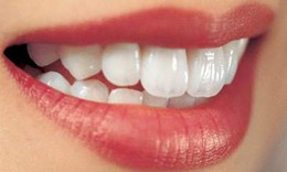 Răng đẹp từ... bếp