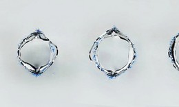 Cách mạng mới về van tim