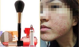 Cảnh gi&#225;c với h&#243;a chất trong mỹ phẩm