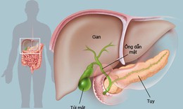 Món ăn thuốc cho người bệnh viêm gan