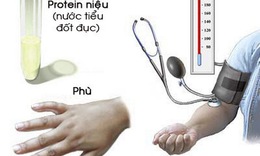 Nhận biết tăng huyết &#225;p thai kỳ