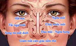 Hắt hơi thành tràng, chữa thế nào?