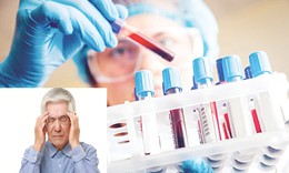 Xét nghiệm máu phát hiện sớm bệnh Alzheimer