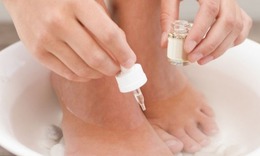 Bệnh nấm móng chân có lây không?