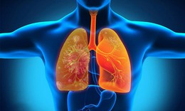 Triệu chứng bệnh bụi phổi