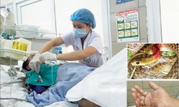 Suýt ch&#234;́t vì... rắn cảnh