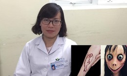 Từ trào lưu Momo, chuyên gia y tế phân tích về hành vi tự làm hại bản thân ở trẻ