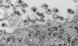 Ph&#225;t hiện chủng virus HIV mới sau 20 năm