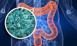 Khắc phục rối loạn tiêu hóa do dùng thuốc kháng sinh thế nào?
