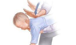 Cảnh báo hóc dị vật do ăn hoa quả ở trẻ
