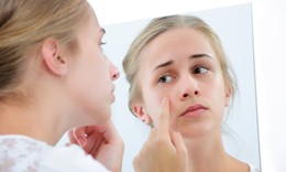Da dễ dị ứng, c&#243; cách nào làm đẹp?