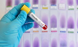 Chlamydia làm tăng gấp đôi nguy cơ ung thư buồng trứng
