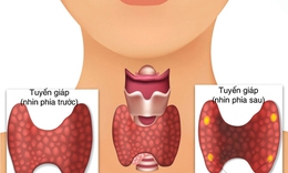 C&#225;c thuốc điều trị một số bệnh l&#253; tuyến gi&#225;p