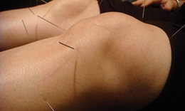 Điều trị tho&#225;i h&#243;a khớp gối