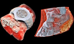 Phim Xquang màu đầu tiên trên thế giới