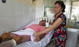 Hồi sinh nhờ… da của  người kh&#225;c
