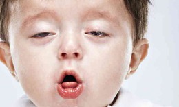 L&#224;m sao để biết con bạn bị hen?