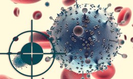 Điều trị đ&#237;ch l&#224; g&#236;?