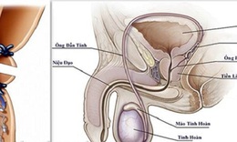 Thắt ống dẫn tinh - Biện ph&#225;p tr&#225;nh thai hiệu quả, &#237;t rủi ro