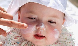 Lo lắng thường gặp khi trẻ bị eczema