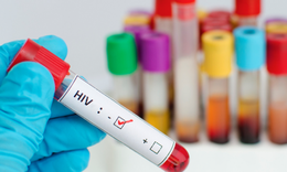 Khởi động Dự &#225;n Quỹ To&#224;n cầu ph&#242;ng, chống HIV/AIDS giai đoạn 2018-2020