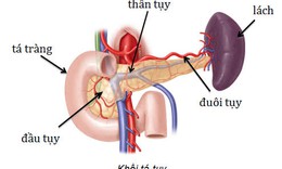 B&#225;c sĩ chỉ c&#225;ch ph&#225;t hiện căn bệnh ung thư &#225;c t&#237;nh nhất của đường ti&#234;u h&#243;a